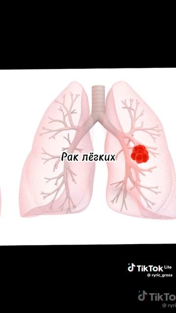 От чего умерли известные люди часть третья