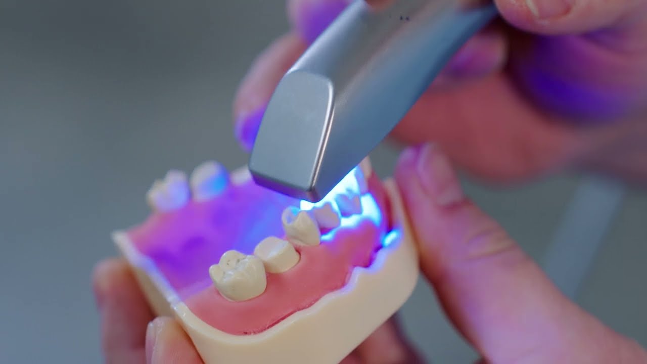 Свойства сканера, порядок сканирования. Этап Съемка. CEREC SW 5.2