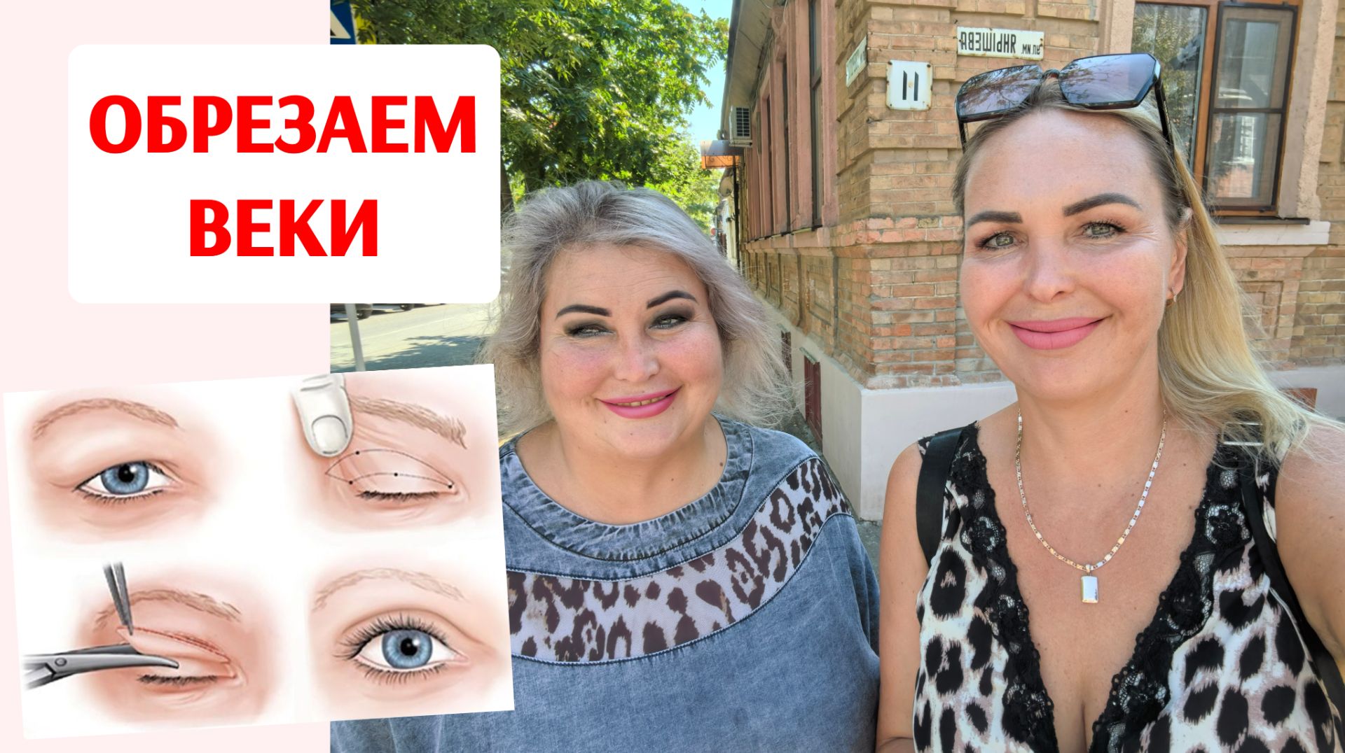 СКОРО ЕДЕМ ОБРЕЗАТЬ ВЕКИ. ВСЁ  РЕШЕНО