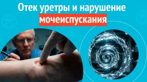 😰 Отек уретры и нарушение мочеиспускания. Клинический случай № 1835