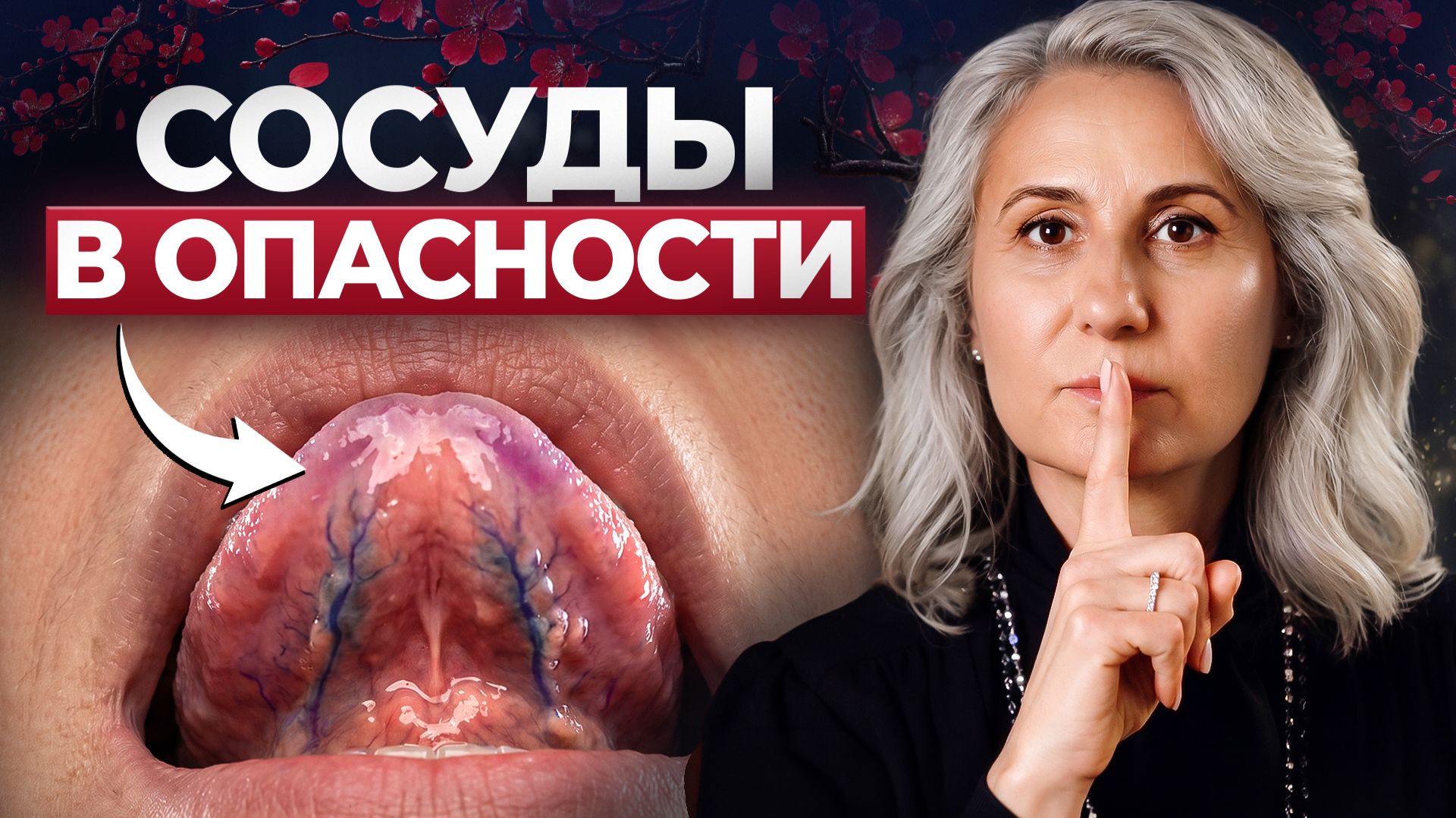 Что тело говорит за МЕСЯЦ до инфаркта или инсульта? 3 признака, которые вы не должны пропустить!