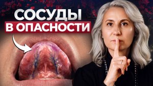 Что тело говорит за МЕСЯЦ до инфаркта или инсульта? 3 признака, которые вы не должны пропустить!