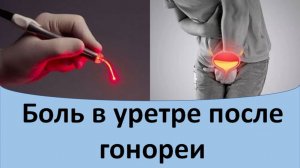 Боль в уретре после гонореи