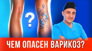 Все о варикозе: причины, симптомы и бесплатная операция по ОМС
