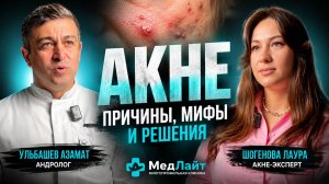 Акне/ ГЗТ/ тестостерон/ Ульбашев Азамат-андролог/ Шогенова Лаура-акнеэксперт.