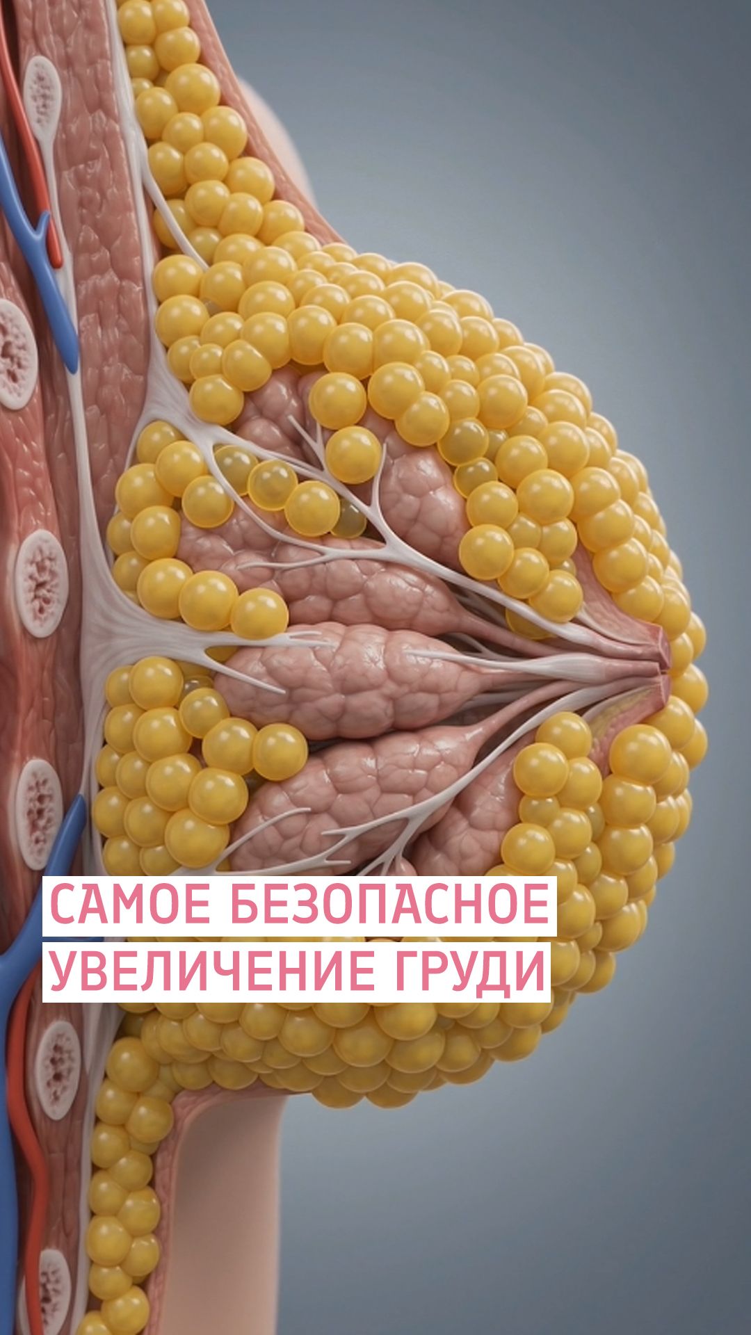 Липофилинг - увеличение груди собственным жиром / Евлахова Наталья Алексеевна Пластический хирург
