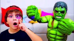 КТО ОБИДЕЛ КАМИЛЯ?! Ужасный фингал под глазом... 😱🥊