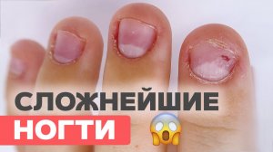Как восстановить обгрызенные ногти? Способ отрастить натуральную длину