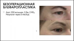 Что на самом деле дает клинике PLADUO? Вебинар Ольги Соколовой