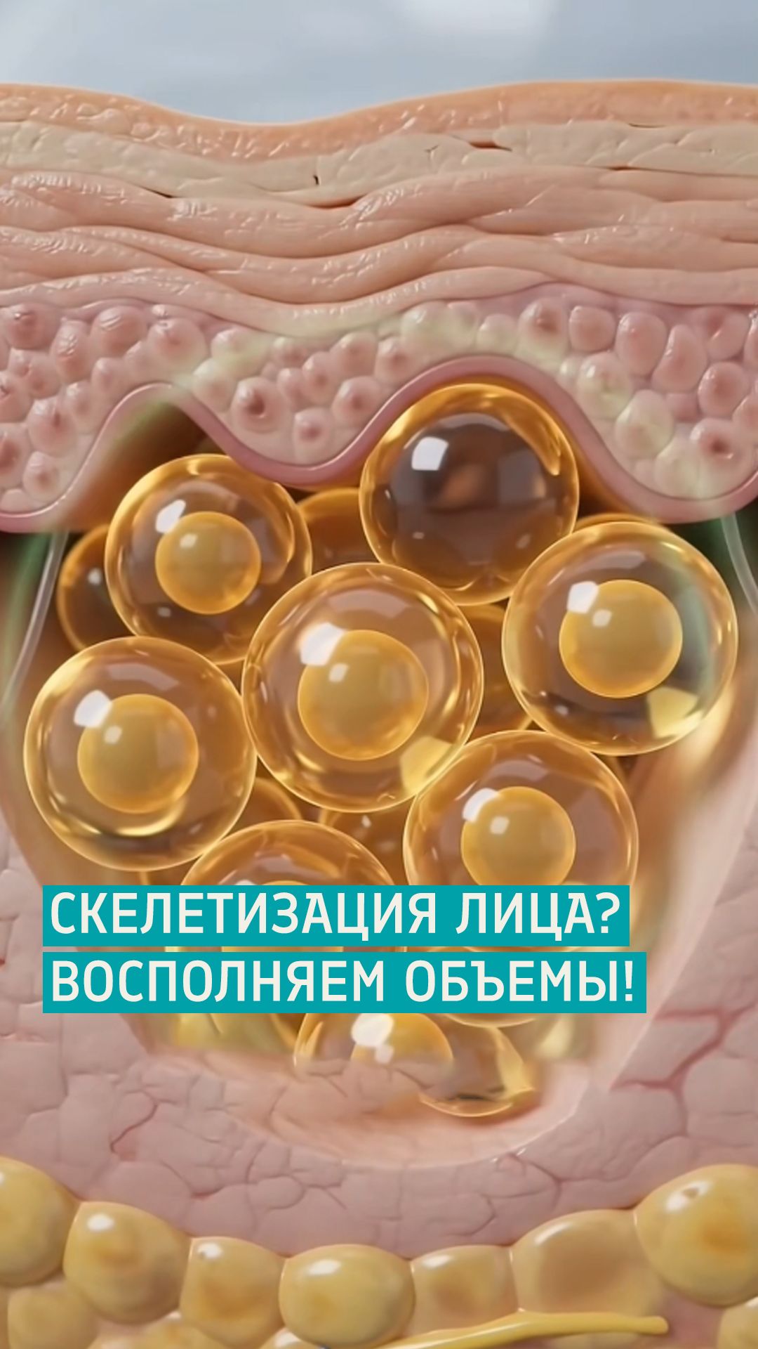 Омоложение лица собственным жиром - восполняем объем без филлеров! / Протасов Кирилл Андреевич