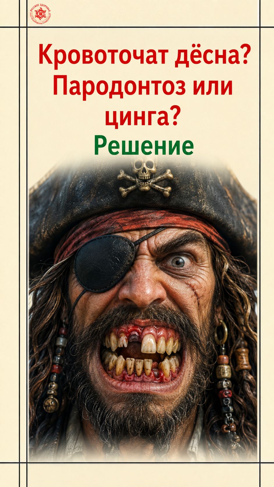 Кровоточат дёсны? Пародонтоз это или цинга? Решение