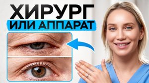 Как подтянуть нависшее веко БЕЗ ОПЕРАЦИИ? Вся правда от хирурга