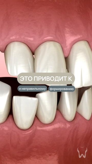 Благодаря этому аппарату у вашего ребенка не будет проблем с прикусом