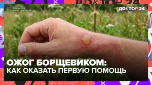 В больницу из-за борщевика: как защититься от ожогов и оказать первую помощь | Доктор 24