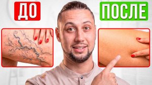 Сосудистые сеточки на ногах УЙДУТ СРАЗУ! За 10 минут в домашних условиях