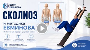 Сколиоз и методика Евминова