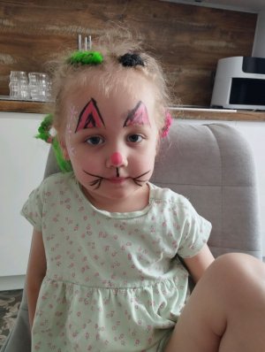 Альбина