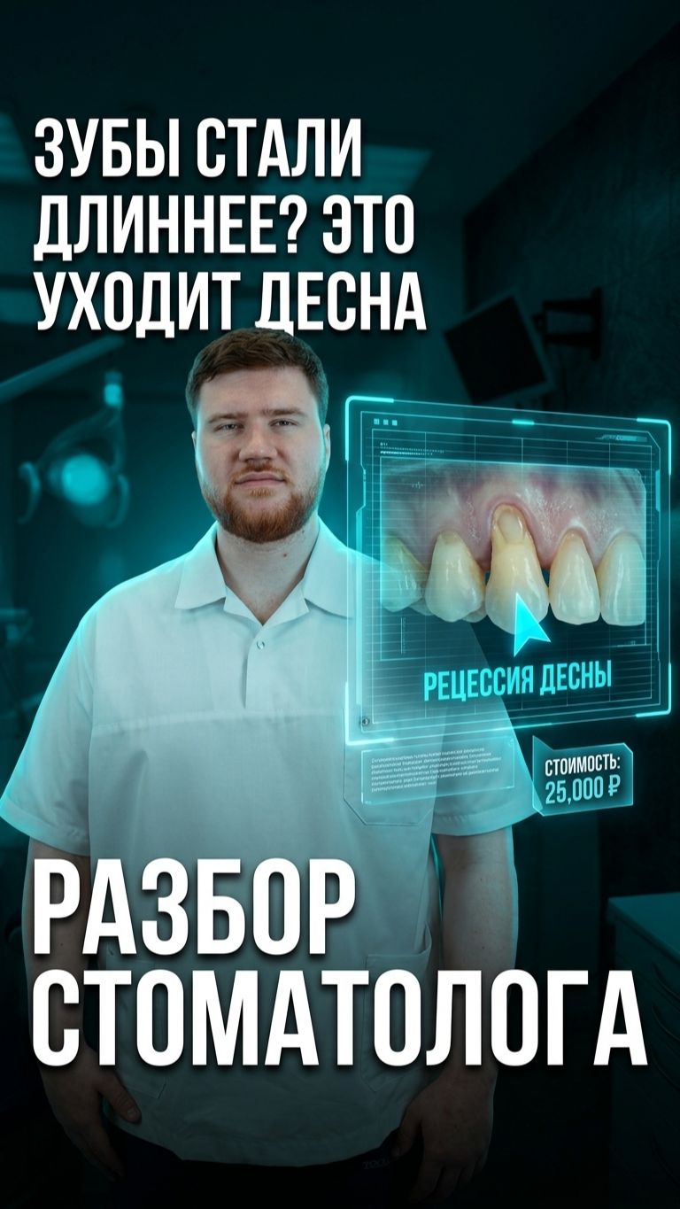 Зубы «выросли»? 😳 Нет — это уходит десна!