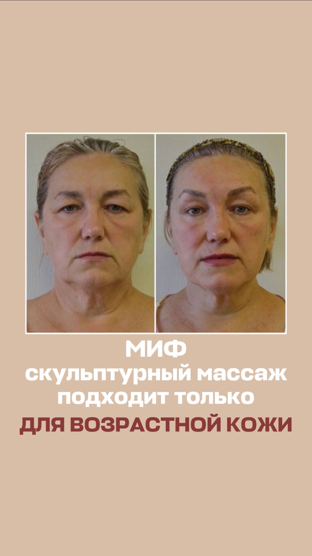 Миф. Скульптурный массаж лица подходит только для возрастной кожи