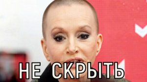 Восстановить невозможно. Названа причина стремительного облысения Аллы Пугачевой