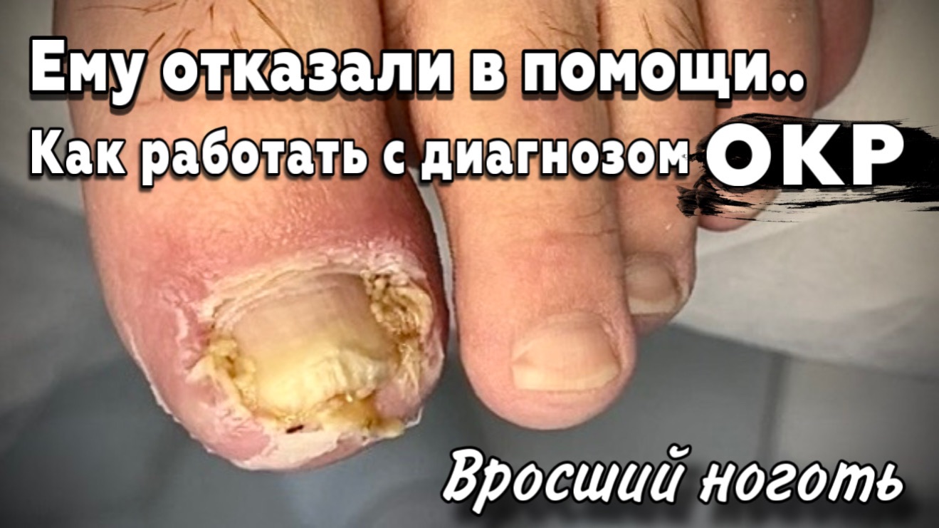Никто не верил, что можно спасти и восстановить ноготь