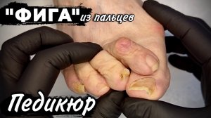 Не смогли подстричь ногти самостоятельно
