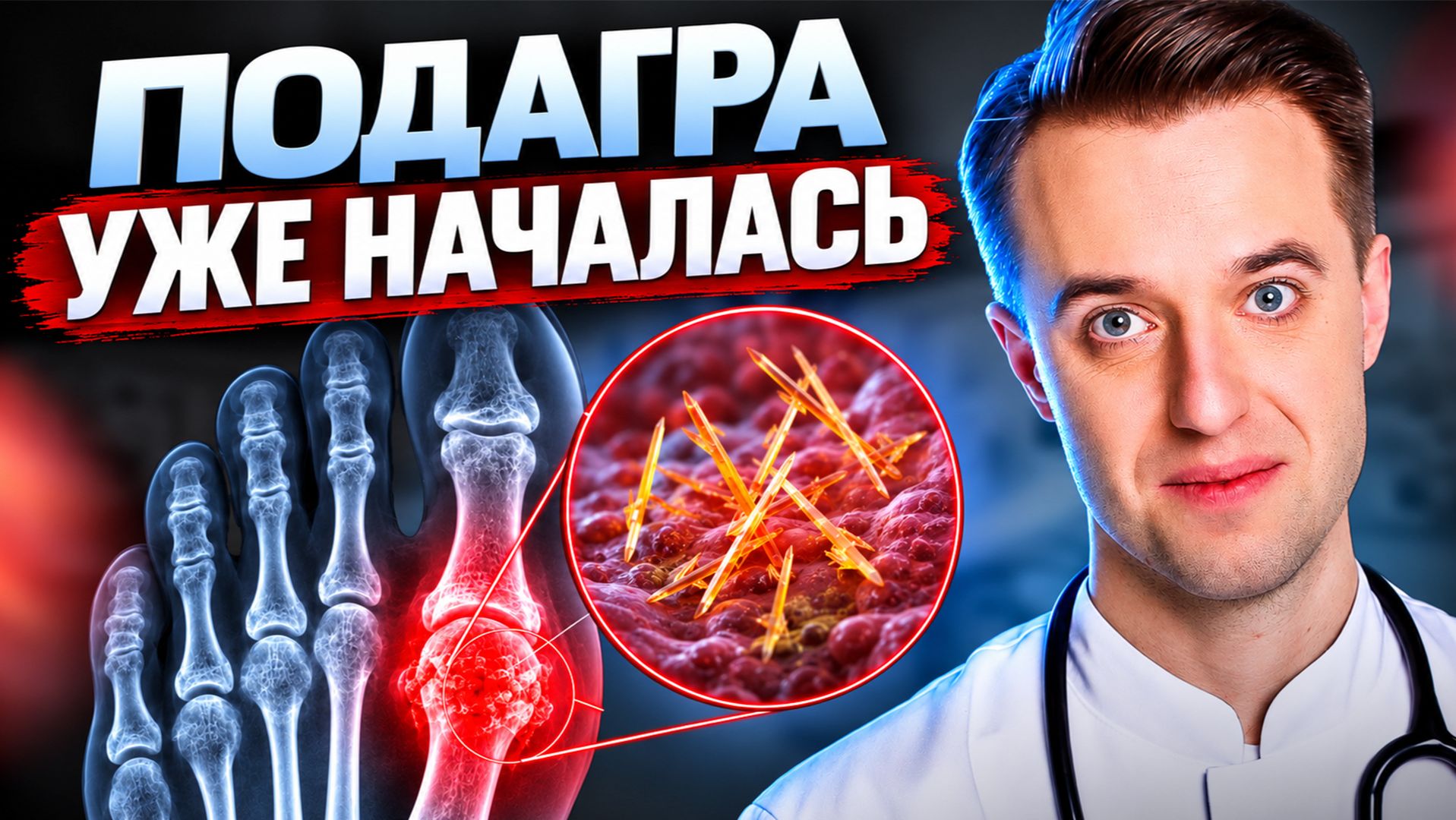 Мочевая кислота 420 — ПОДАГРА УЖЕ НАЧАЛАСЬ. Ты просто не чувствуешь