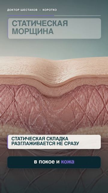 Почему морщины могут остаться после Ботокса?