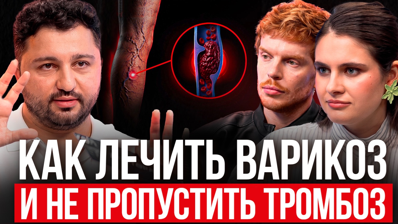 ВАРИКОЗ, ТРОМБОЗ, АРТРОЗ. ЧТО НЕЛЬЗЯ ДЕЛАТЬ и КАК ЛЕЧИТЬ СОСУДЫ? Флеболог