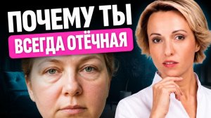 Отеки уйдут, если убрать ЭТИ 6 ПРИВЫЧЕК | Как БЫСТРО убрать отеки с лица