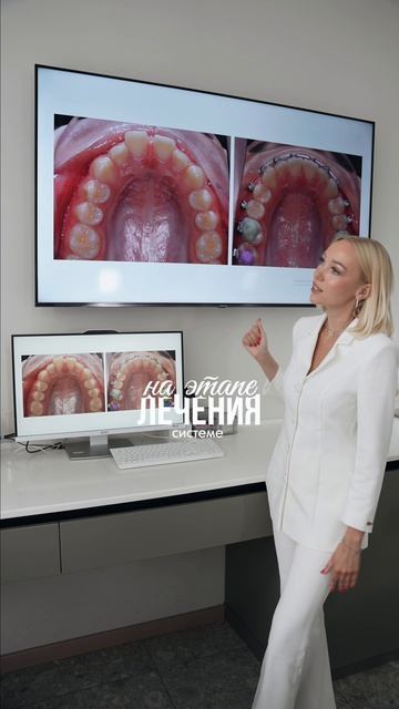 Разбор кейса