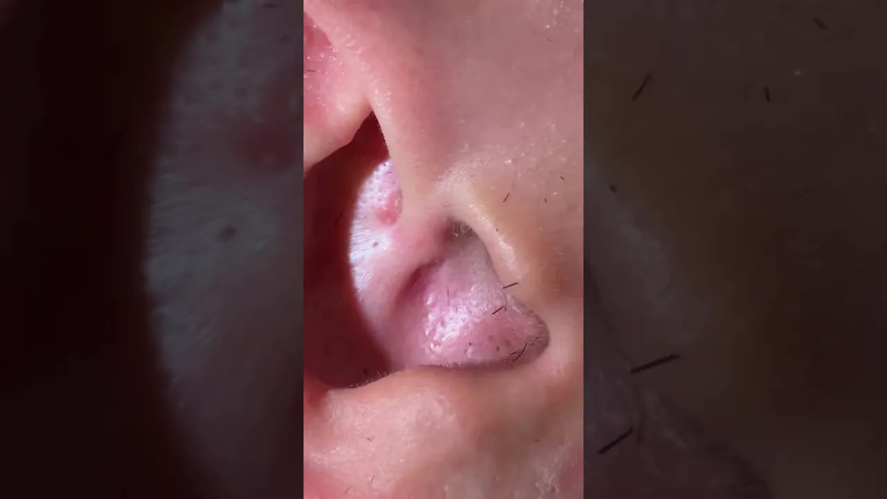 Счастливые уши удаление