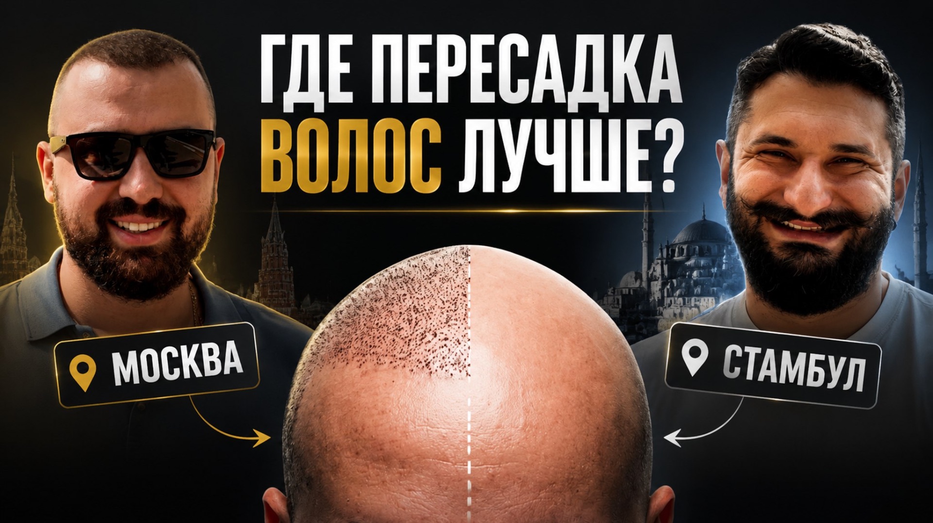 ГДЕ ПЕРЕСАДКА ВОЛОС КАЧЕСТВЕННЕЙ? МОСКВА VS СТАМБУЛ