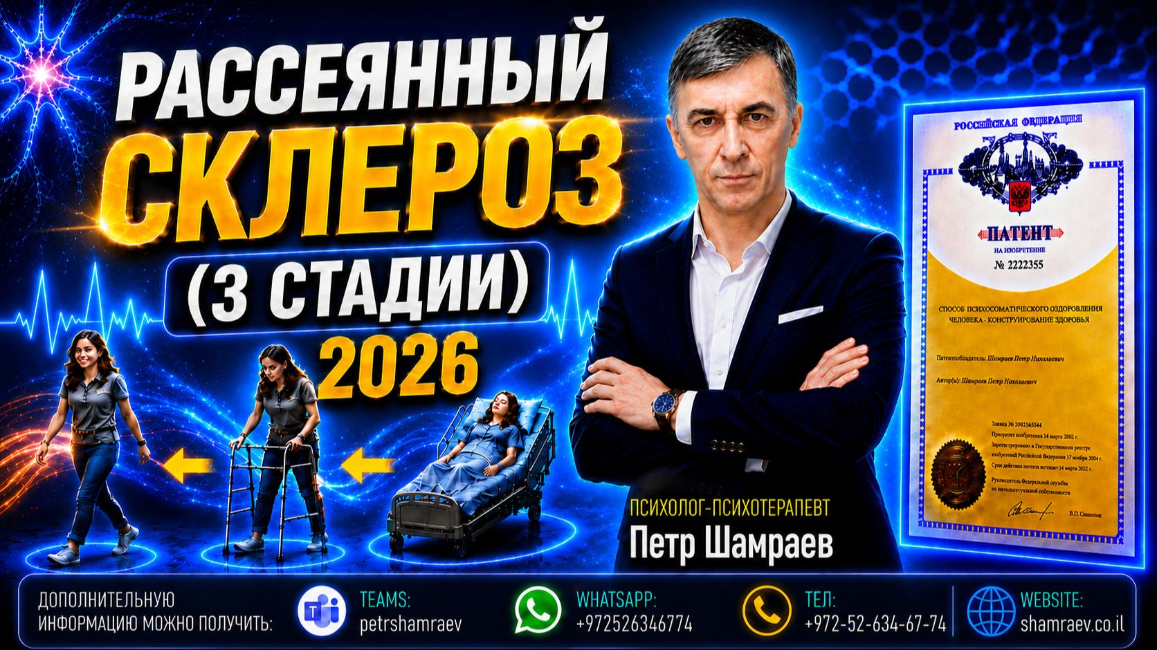 Рассеянный склероз (3 стадии) 2026