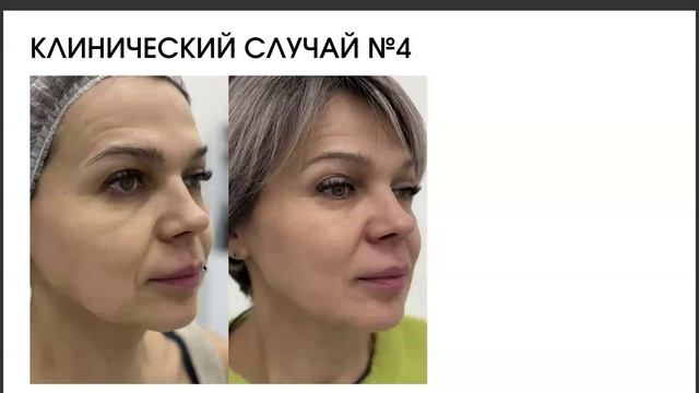 Обучающий курс