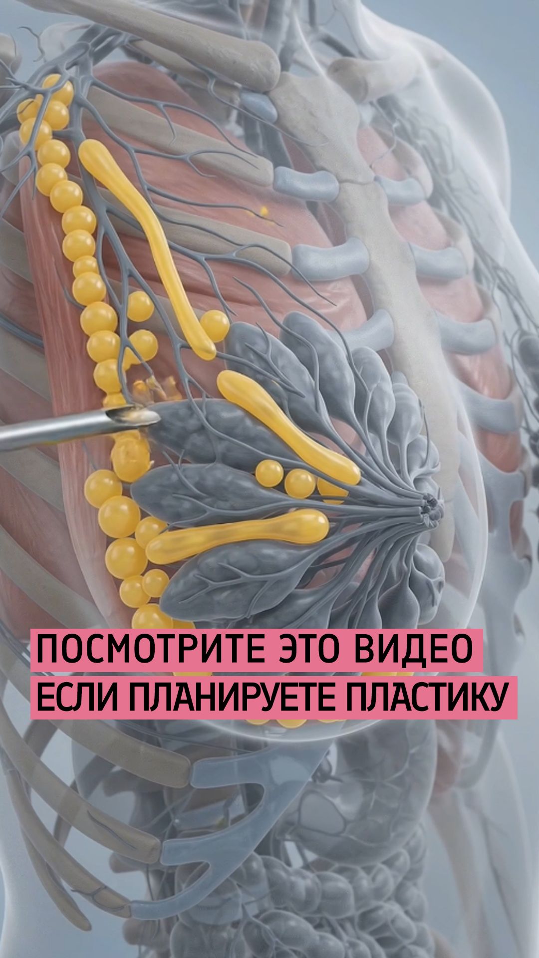 Планируете всю жизнь менять имланты? / Бурлова Мария Григорьевна Пластический хирург