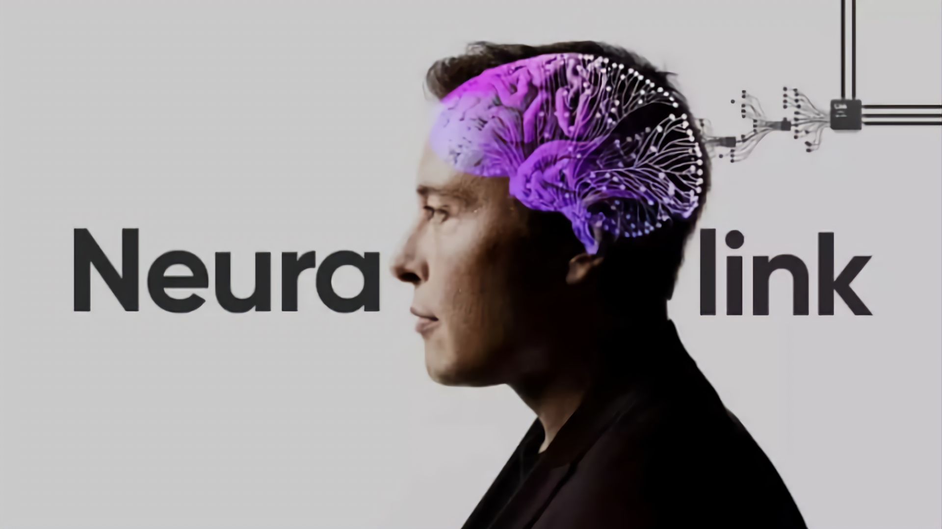 Neuralink тестирует мозговой имплант N1