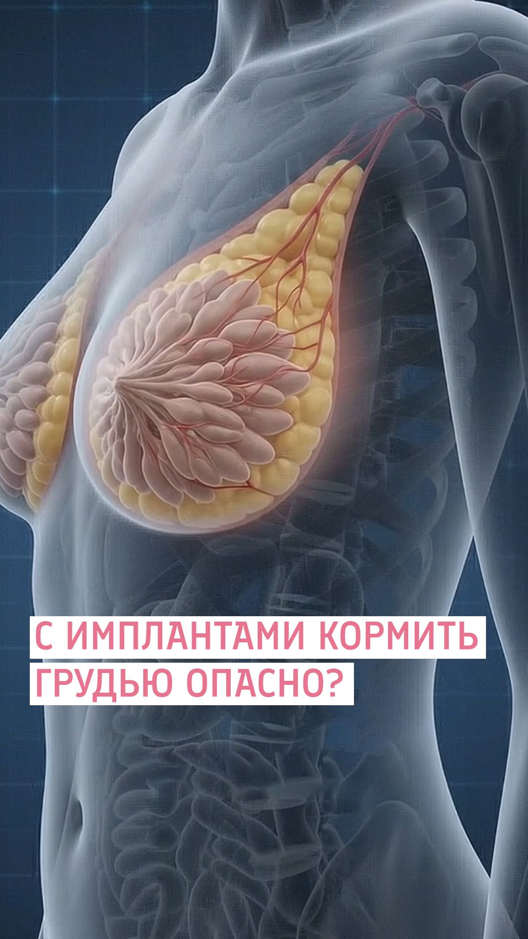 После увеличения груди - грудное вскармливание опасно для ребенка? / Евлахова Н.А.