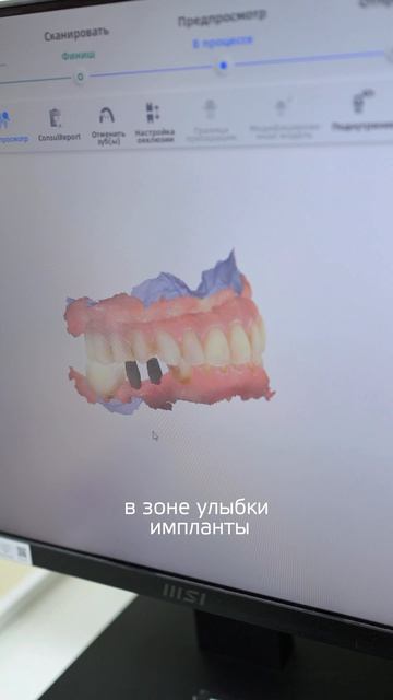 Голливудская улыбка — это про технологию, а не про удачу.