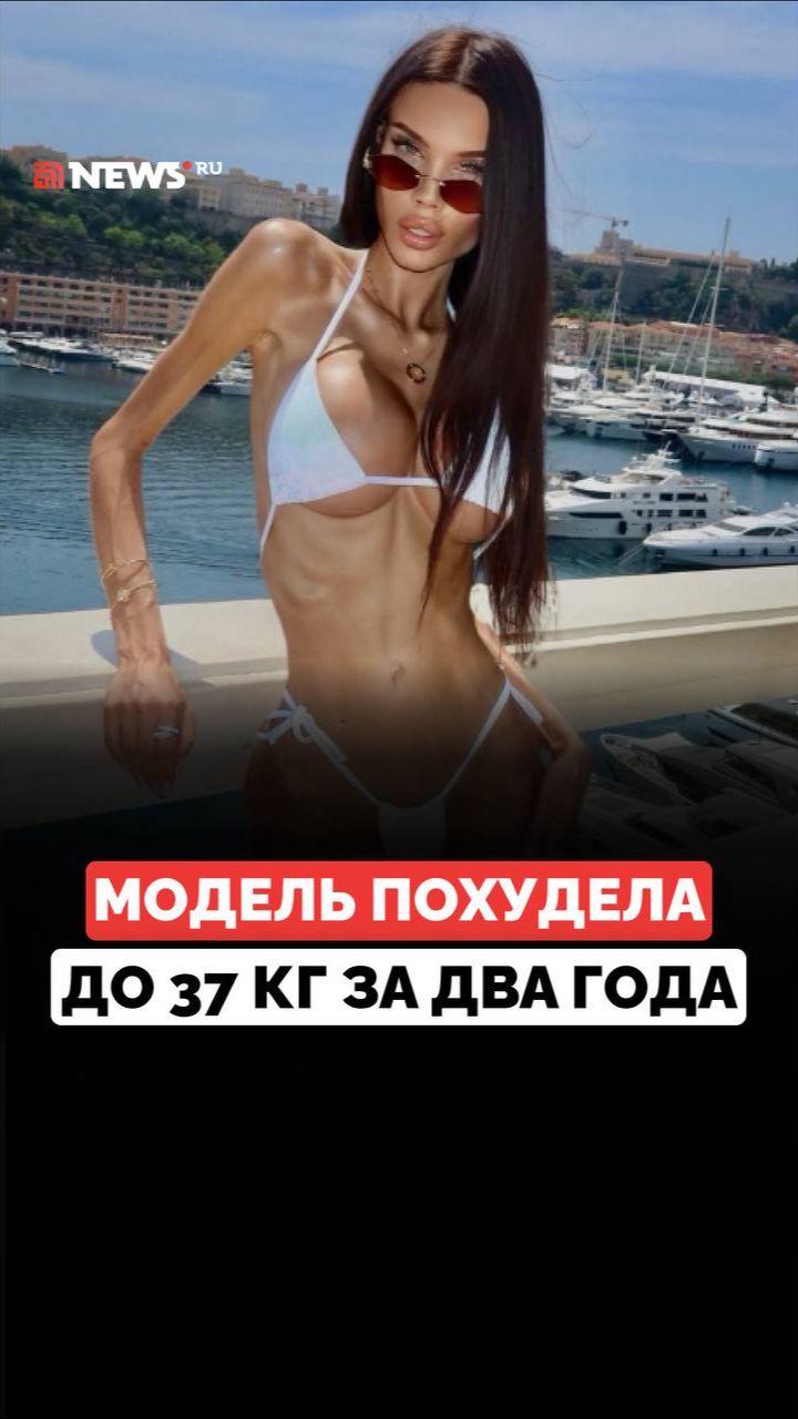 Весит 37 кг, отказывается от еды и делает уколы: какой была фрик-модель Валентина Мелис до пластики