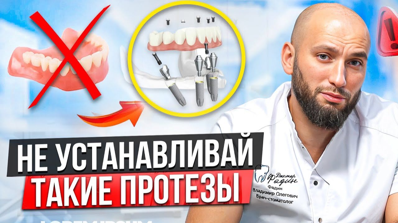НИКОГДА не ставь такие ПРОТЕЗЫ! Главные ОШИБКИ!