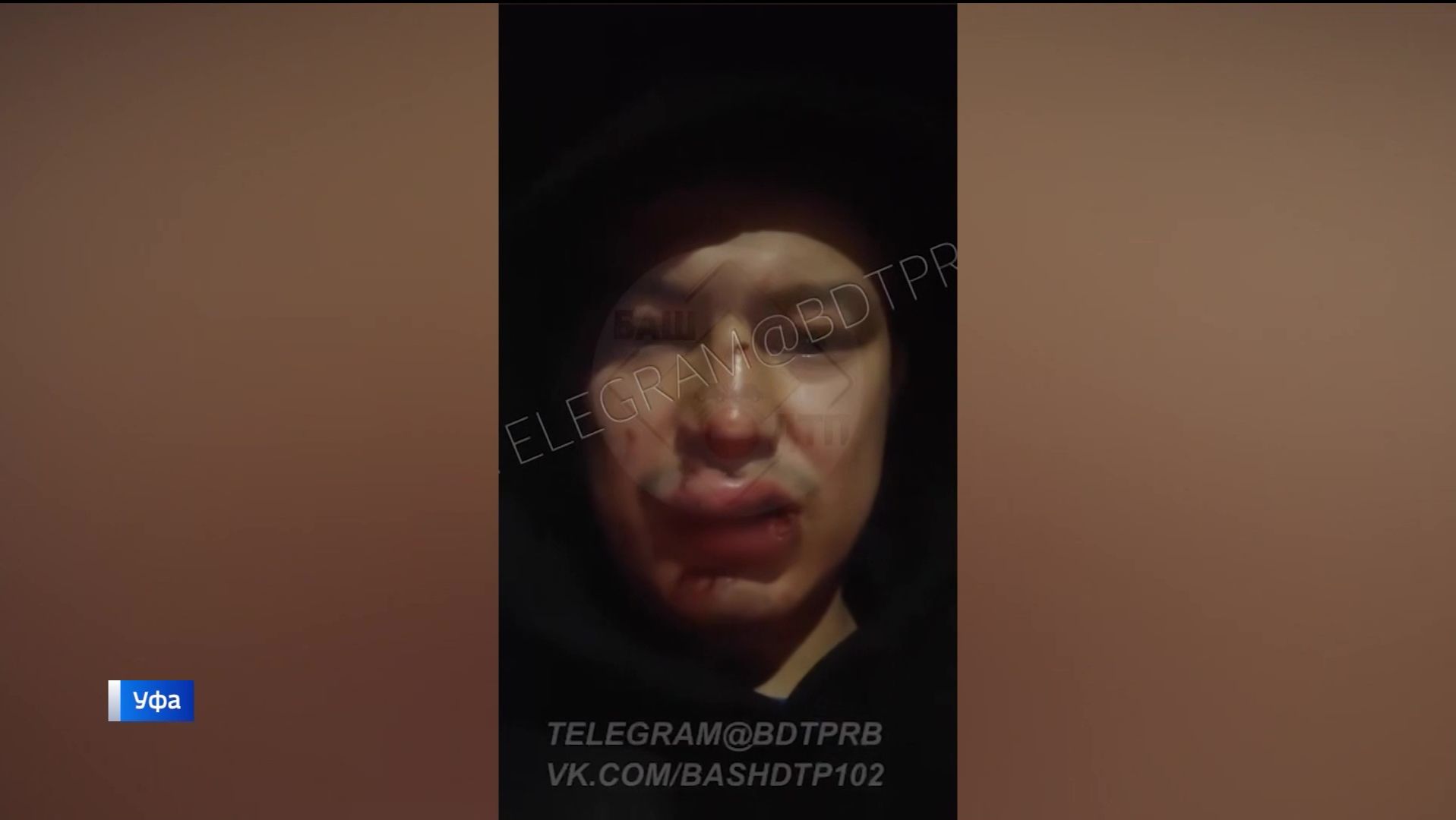 Уфимец упал в выбоину на пересечении улиц Мубарякова и Софьи Перовской и сломал четыре зуба