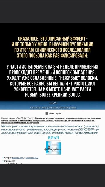 Бросила бы курс на 4-й неделе, если бы не знала про это 👇

Волосы вдруг посыпались сильнее обычного