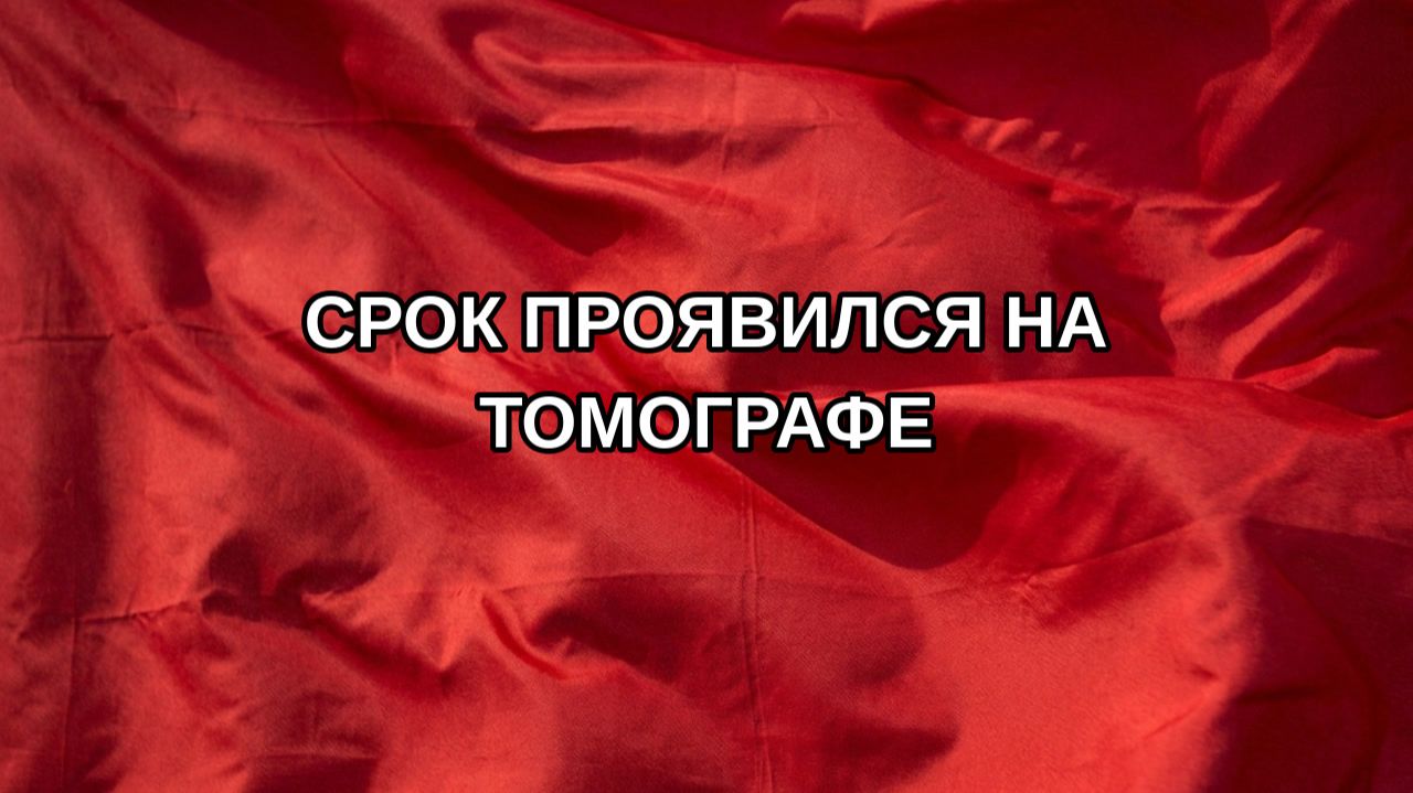 Срок проявился на томографе