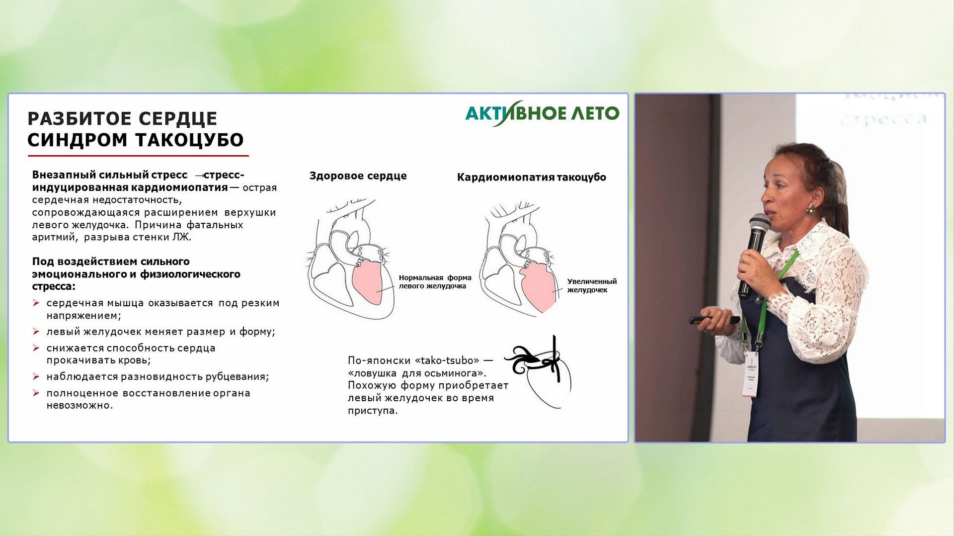 Синдром Такоцубо. Турченко И. В.