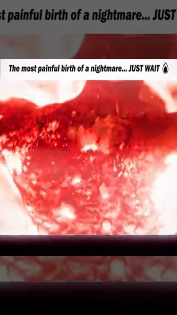 The Most Painful Birth Of A Nightmare JUST WAIT Shorts
