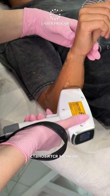 Laser ProLab