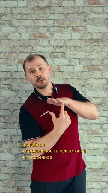 Плоскостопие