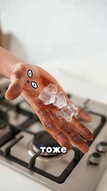 Что делать при ожоге?🤯