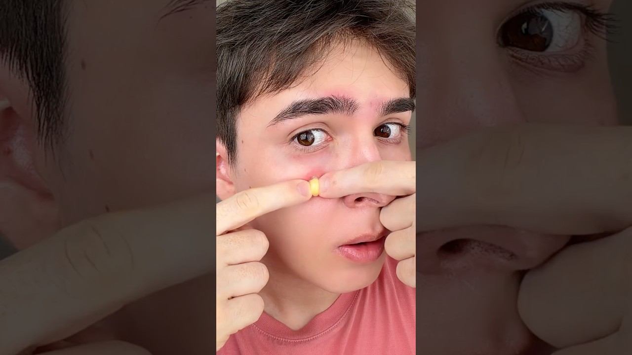 Crazy Skincare!